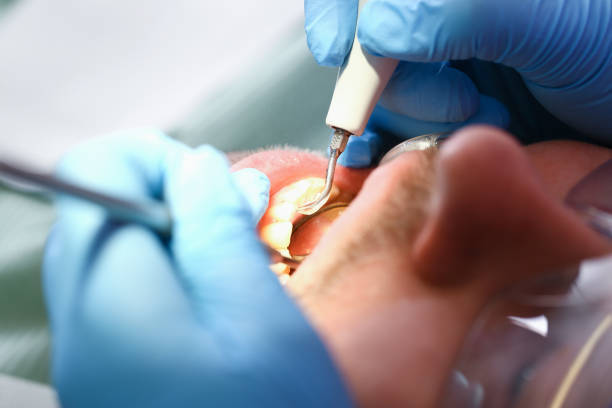 Best Emergency Treatment for Oral Infections in Merrillville, IN