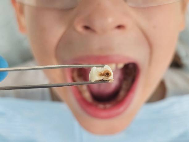 Professional Emergency Dental Service in IN